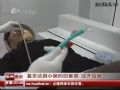 引入新技术 非手术治疗疾病